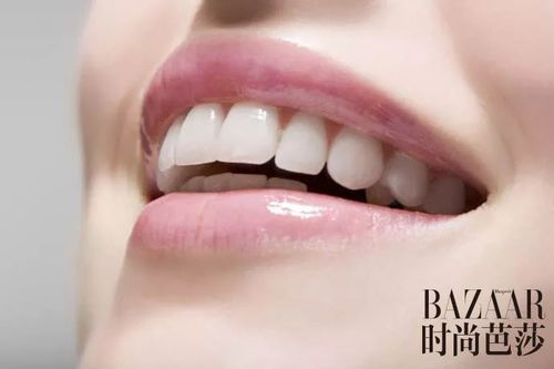 吳宣儀 牙齦笑 好甜 關(guān)于美牙你還得知道這些