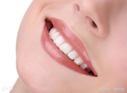 瀾宮薇 如何美白牙齒 從這幾個(gè)方法入手
