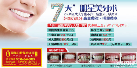 韓國仿真牙好嗎?-美顏健身區(qū)-杭州19樓