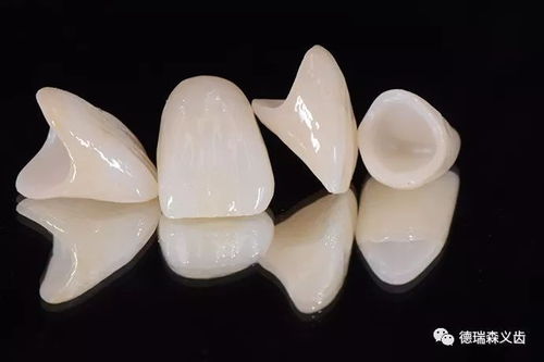 全瓷牙 牙齒修復(fù)的好材料