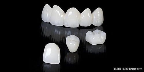 想要一天解決牙齒美容修復(fù) 牙醫(yī)推薦這個(gè)
