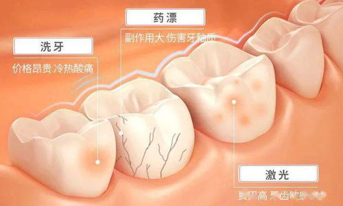是什么 黑 科技護(hù)牙方式風(fēng)靡全網(wǎng) 專業(yè)美白健齒,冷光牙貼成就一瞬亮白