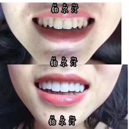 鉑爾汀 2019年9月精品小班牙齒美容課程結(jié)束,學(xué)員們順利畢業(yè)