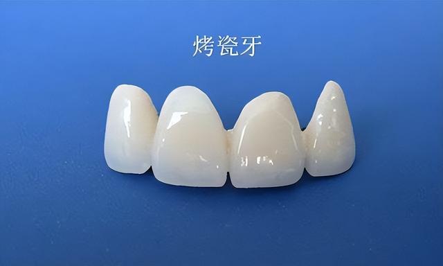 美白牙齒能恢復原本的白色,但需要時間,在美白前要做好準備工作