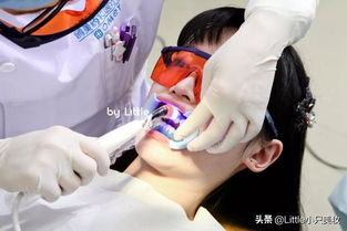 黃牙妹自救指南 這里有我用過最有效的牙齒美白產品